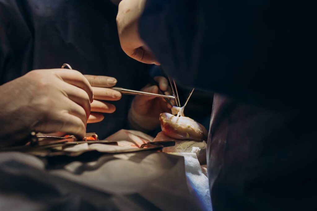 Пересадка нирки в Івано-Франківську: після 16 років діалізу чоловік повернувся до футболу і прогулянок із сином